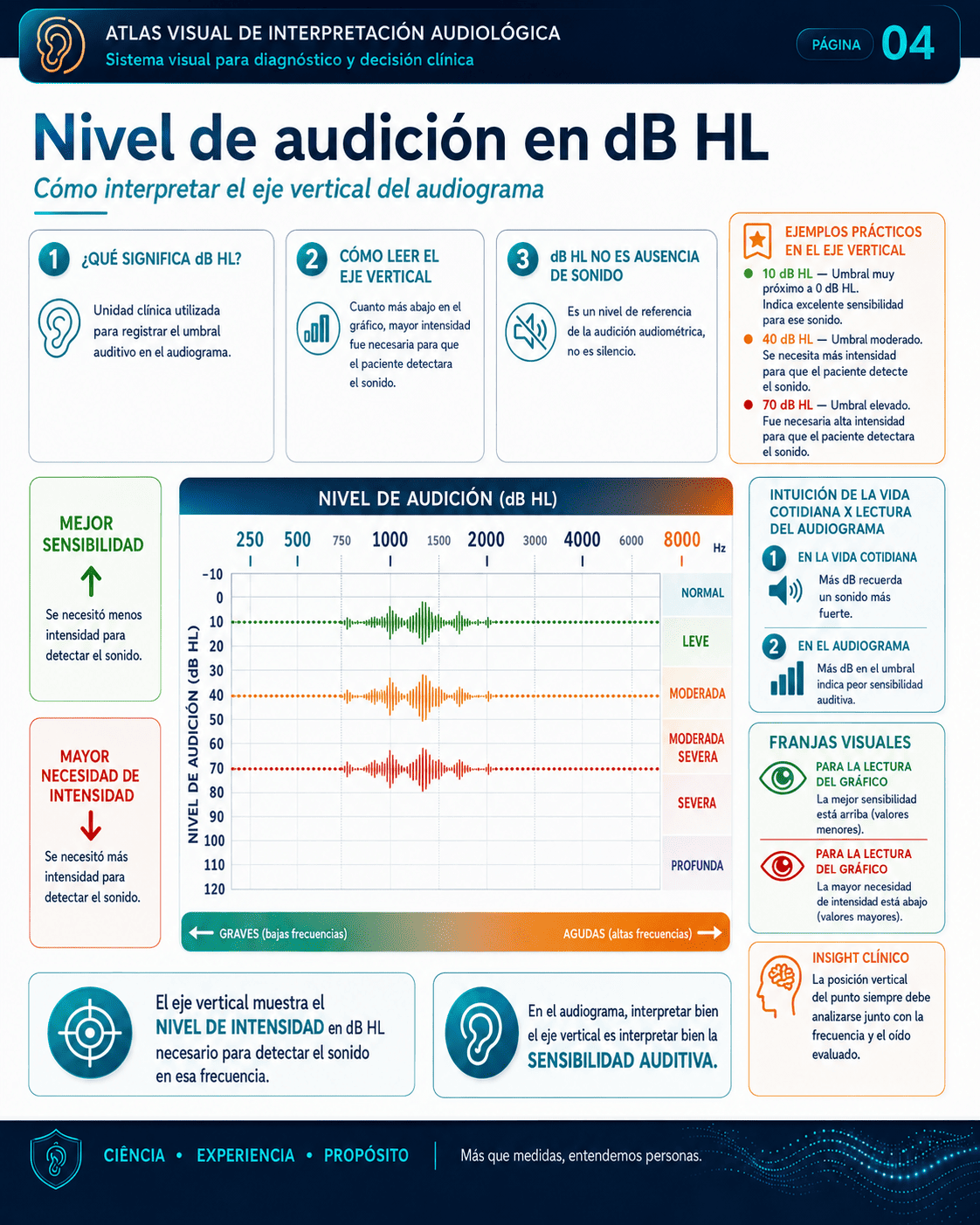 Muestra real del Sistema Visual de Interpretación Audiológica
