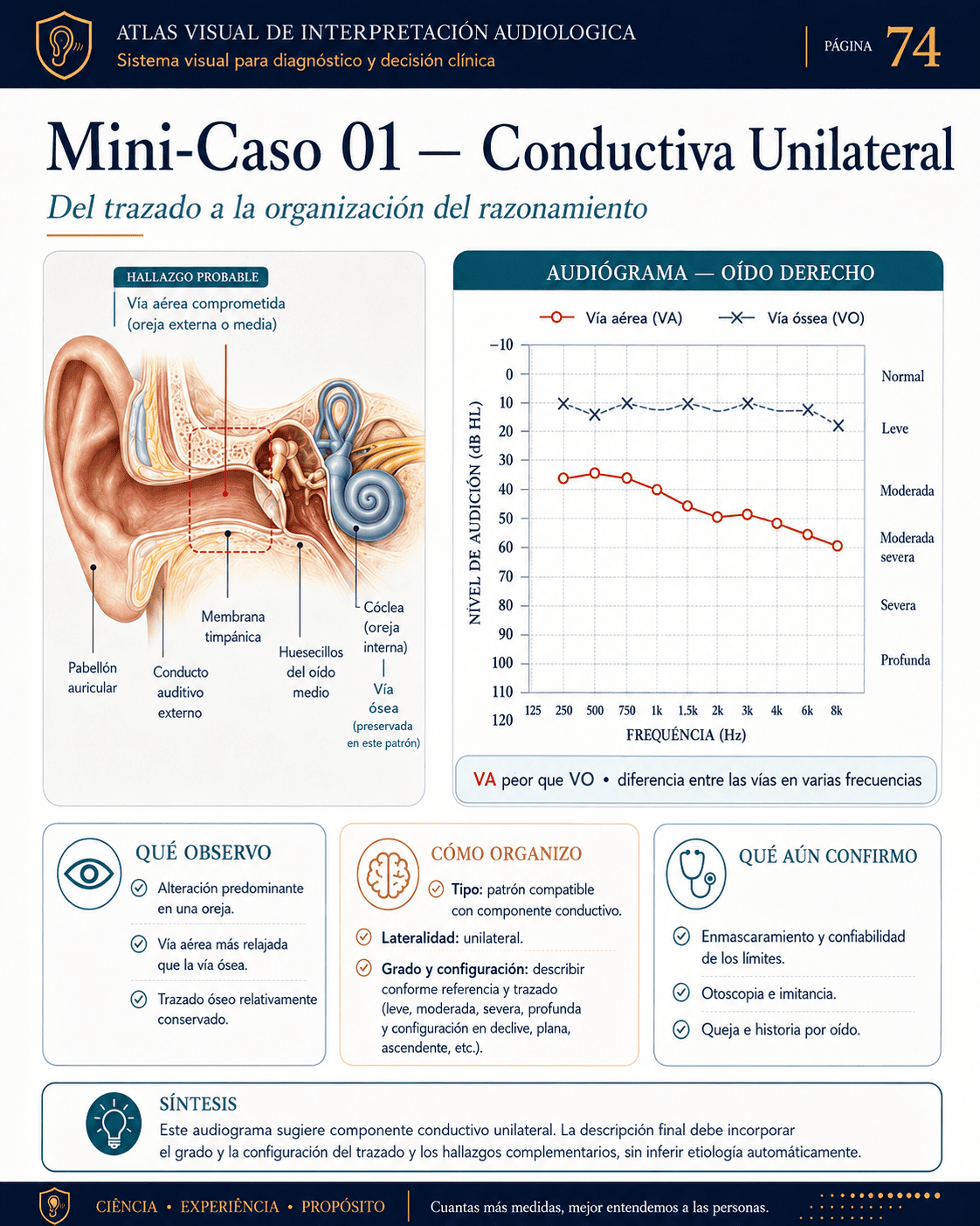 Muestra visual de interpretación audiológica